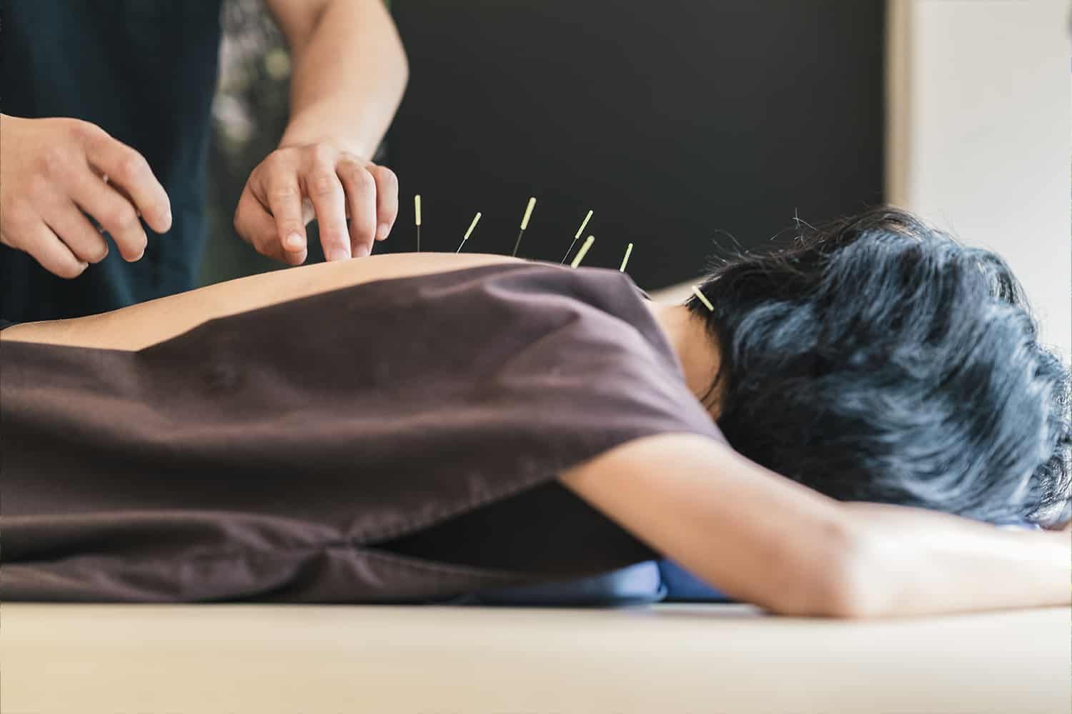Acupuncture Therapy URP